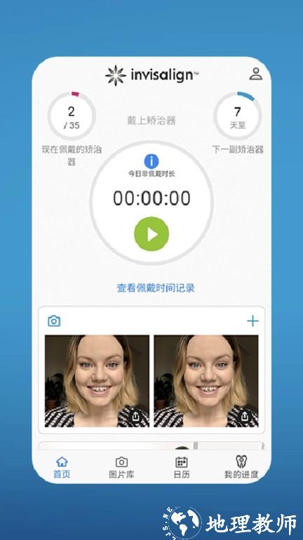my invisalign 最新版本 v5.5.2 安卓版 3