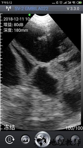 智能B超app2