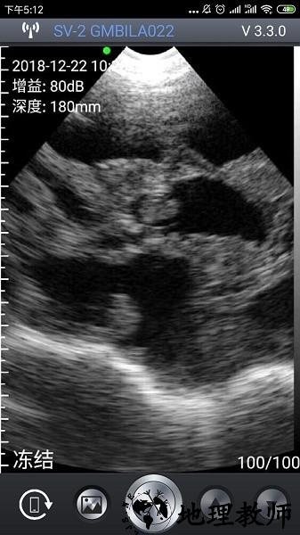 智能B超app1