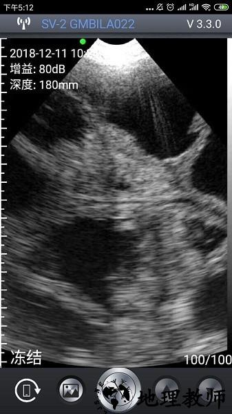 智能B超app3