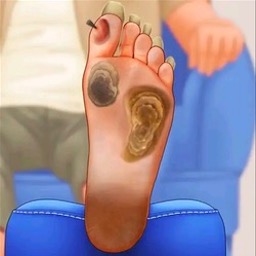 修脚足疔模拟器移植版